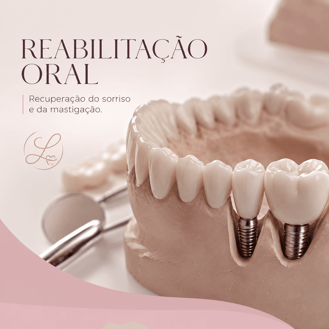 Reabilitação Oral