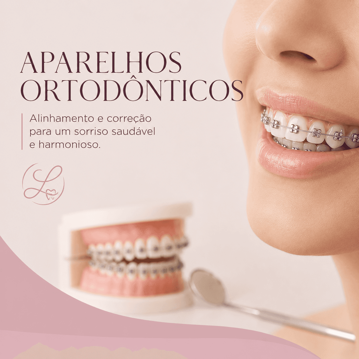 Aparelhos Ortodônticos