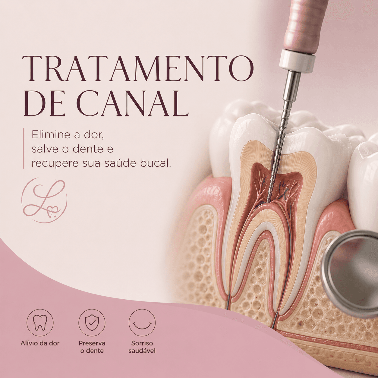 Tratamento de Canal